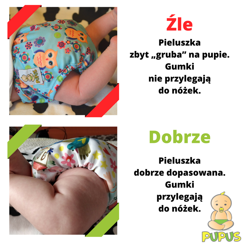 pieluchomajtki komu przysługuja