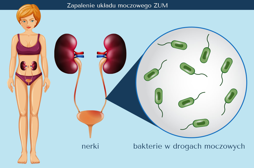 zniżka na pieluchy dla dorosłych