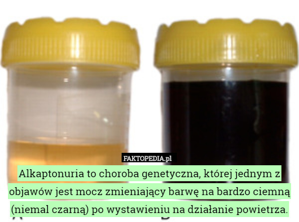 Dr.Browns SB41005 Opcje Antykolkowa butelka dla niemowląt z wąską szyjką