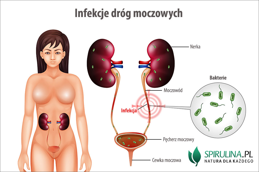 pieluchomajtki refundacja 2017 kto pierwszy wystawia